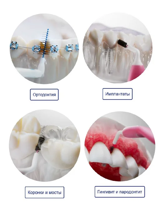 Vitis Ершики для зубов межзубные Interprox Plus Micro PHD 1.1, вариант, фото 7