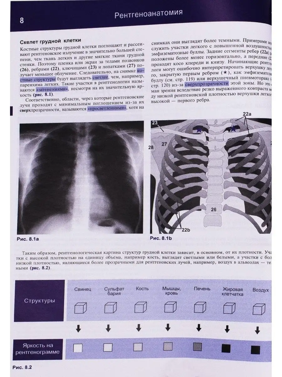 Рентген. исследование грудной клетки Медицинская литература 103758933  купить за 2 355 ₽ в интернет-магазине Wildberries