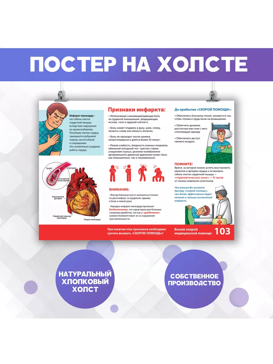 Постер на стену Инфаркт, болезни сердца, медицина 30х40 см PosterNak  104199801 купить за 722 ₽ в интернет-магазине Wildberries